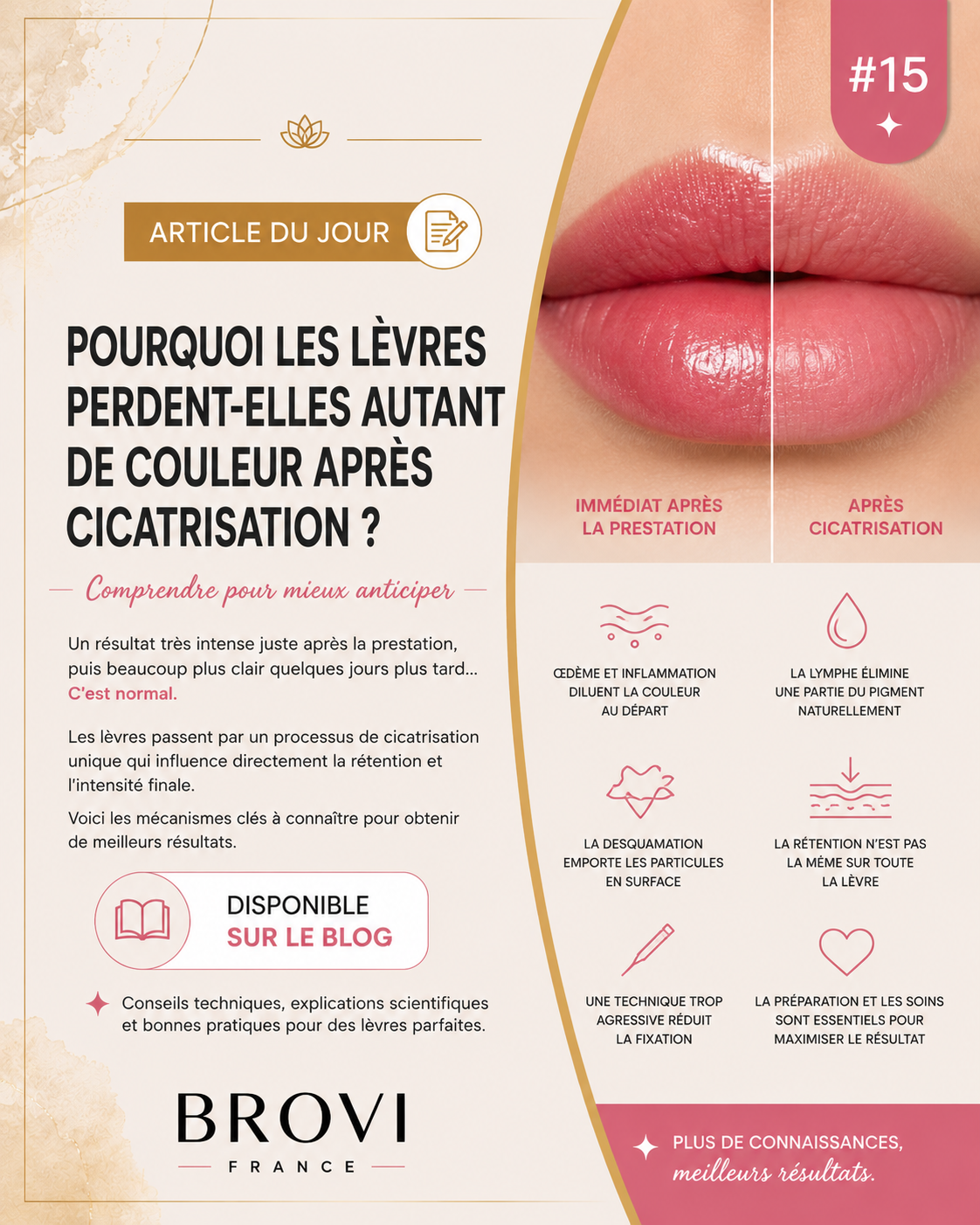 Lèvres pigmentées avant et après cicatrisation illustrant la perte d'intensité naturelle après un maquillage permanent.